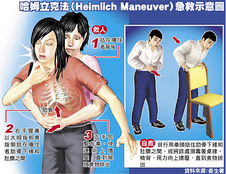 Heimlich Maneuver.jpg